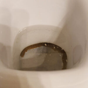 Toilette_Abfluss_dreckig